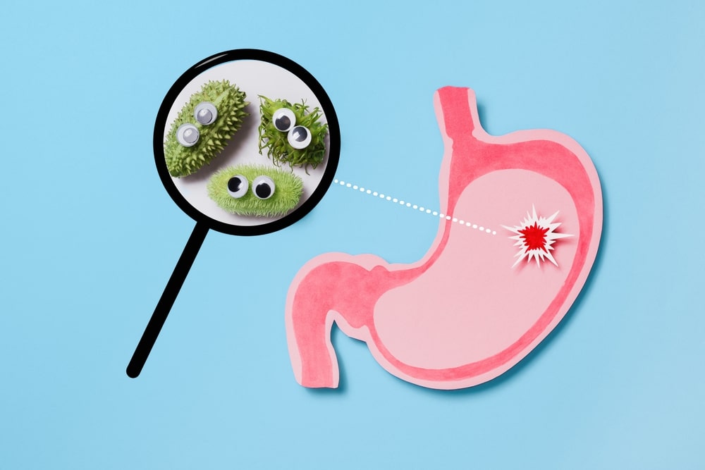 Illustration représentant la prolifération de la bactérie H. pylori dans l'estomac