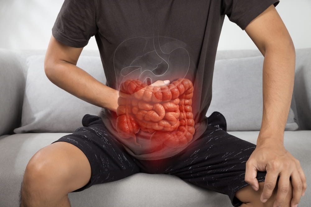 Ilustration représentant un homme avec le syndrome de l'intestin irritable, ou côlon irritable